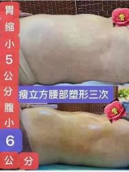-瘦立方身材管理中心