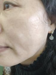 -长沙雅美医疗美容医院