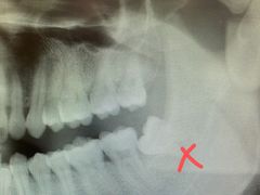 -宁波口腔医院(鄞州分院)