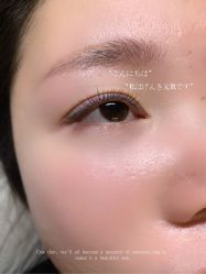 -宥莉·ULLY 痘敏肌•科技皮肤管理中心