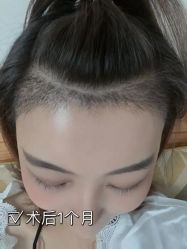 -雍禾植发全国连锁