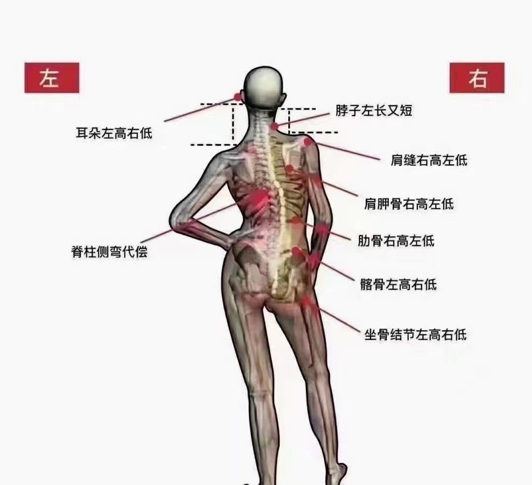 不良体态之三七步
你经常这样站的吧
这样的站姿,会引起长短腿