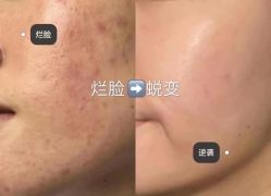 -痘敏医生专业祛痘·肌肤修复连锁