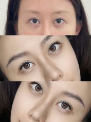 点击看大图 -杨益美学·野生眉半永久纹眉发际线