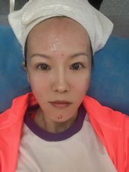 -亿美医疗美容·半岛大超炮官方授权店