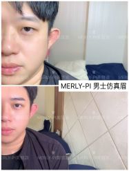 -MLP美丽派·问题肌疗愈中心