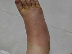 -大韩庄韩氏祖传正骨