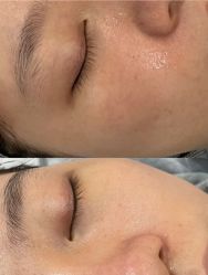 -SKIN79皮肤管理中心