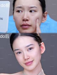 -深圳艺星医疗美容医院