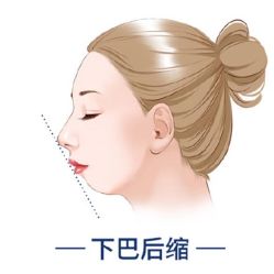 -小颜秘家·韩国整骨