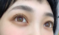点击看大图 -宥莉·ULLY 痘敏肌•科技皮肤管理中心