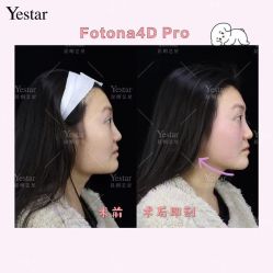 -Yestar艺星医疗美容医院