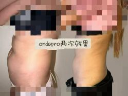 点击看大图 -栖SPA·ONDA ·美芙炫·海菲秀科技美肤中心