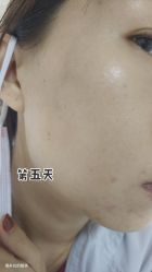 体验后-哈尔滨瑞丽医疗美容医院