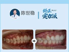 -柏乐口腔(南宁总院)
