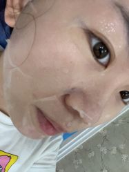 体验后-深圳阳光医疗美容
