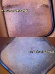 -MLP美丽派·问题肌疗愈中心