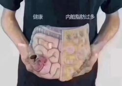 -香薇妮丝·定制减肥·身材管理