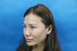 -安徽合肥韩美整形外科医院
