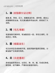 -克丽缇娜