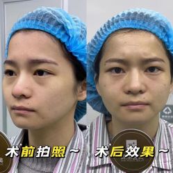 点击看大图 -广州健丽·去眼袋医疗美容机构