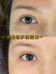 -MLP美丽派·问题肌疗愈中心