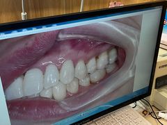 -上海仁爱医院口腔科 · 种植