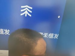 -雍禾植发全国连锁