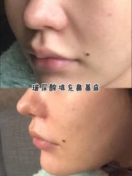 -上海漾颜医疗美容