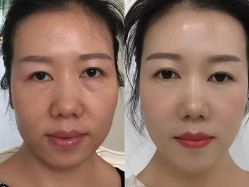 -上海伊莱美医疗美容医院