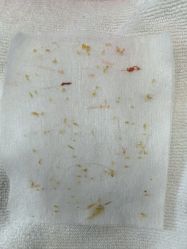 -靓芙泉专研痘痘肌