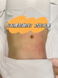 点击看大图 -Lily纤美·科技减脂中心