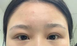 -长沙雅美医疗美容医院