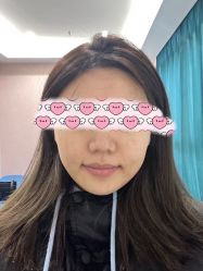 体验前-南昌臻爱医疗美容