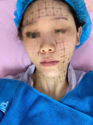 体验前-天津伊美尔医疗整形美容专科医院
