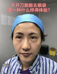 -天津健丽·去眼袋医疗美容机构