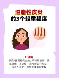 -Bollins波林丝•专研护发中心