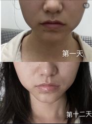 -弘美医美·艾维岚童颜抗衰中心