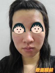 体验后-伊丽莎白医疗美容