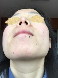 -皇族养心堂·净痘·修敏·御颜