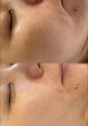 -SKIN79皮肤管理中心
