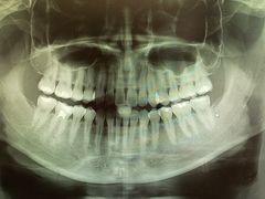 -宁波口腔医院(鄞州分院)