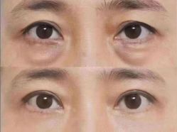 -尊尚柏丽美容SPA