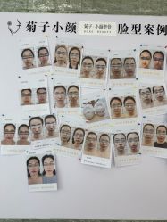 -菊子小颜·日式整骨·产后管理