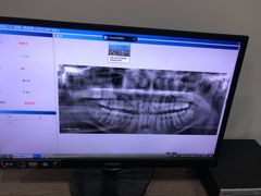 -土豆口腔(凤凰北总店)