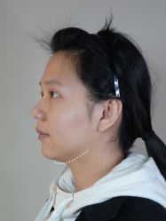 -Yestar艺星医疗美容医院