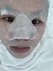 体验后-蕾特恩专业祛痘·皮肤管理