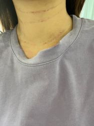 -洁铭新加坡医美