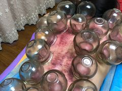-沈师傅盲人按摩工作室(密三小区店)