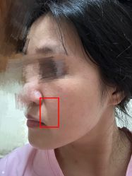 体验后-深圳阳光医疗美容医院·旗舰店